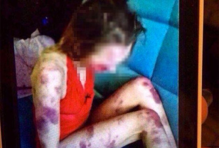 Terlalu Lama Hidup Menjomblo, Wanita Ini Dipukuli Ibunya Hingga Babak Belur