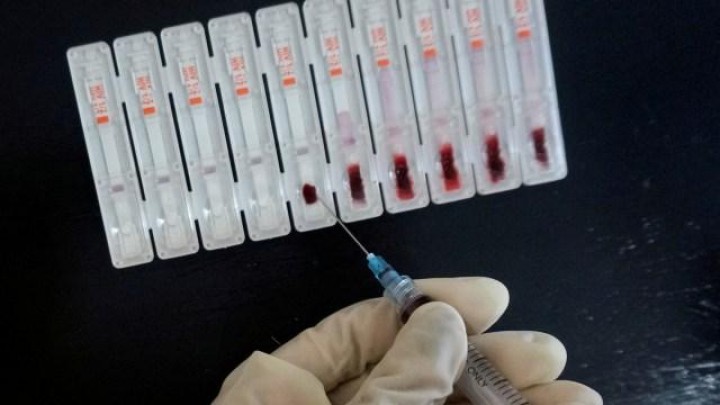 Penderita HIV Akibat Hubungan Sesama Jenis di Aceh Utara Tinggi