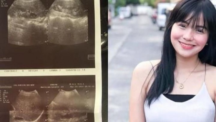 Pingsan Hingga Kejang, Kondisi Mengerikan Akibat Tak Pernah Sarapan