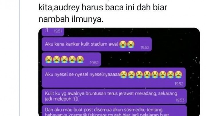 Kena Kanker Kulit Stadium 2 karena Sering Pakai Skincare KW
