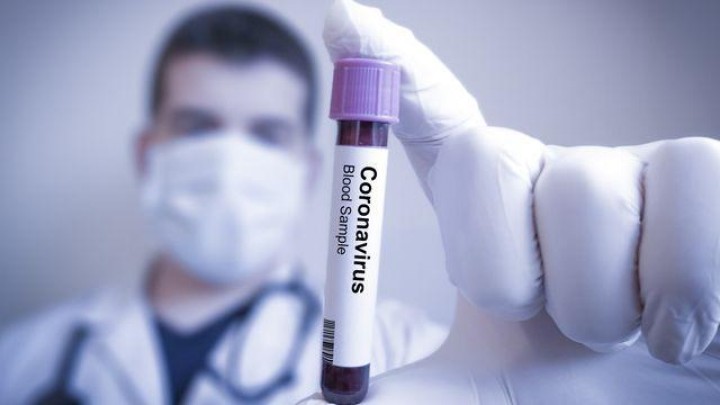 Kasus Positif Corona di RI Melonjak, Jadi 27 Pasien