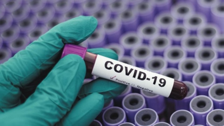 Plasma Darah Pasien Sembuh COVID-19 Diduga Berpotensi Jadi Obat Corona