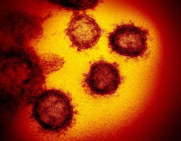 Riset Ungkap Waktu Paling Menular dari Pengidap Virus Corona