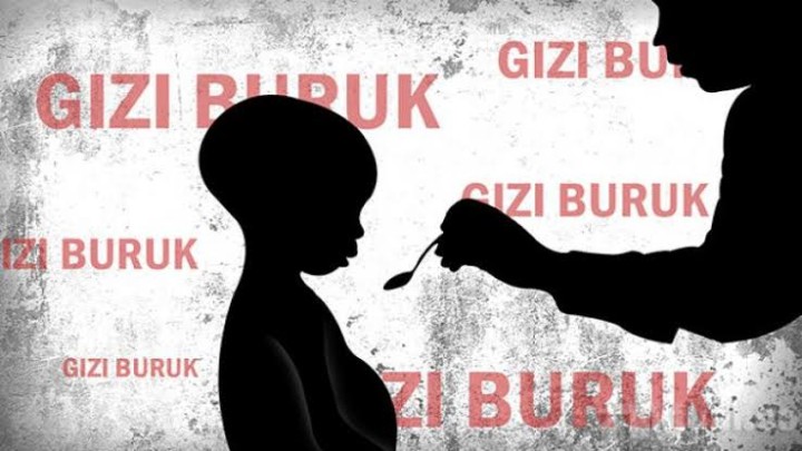 Padahal Habiskan Rp 62 Miliar, Angka Stunting di Bontang Malah Meningkat