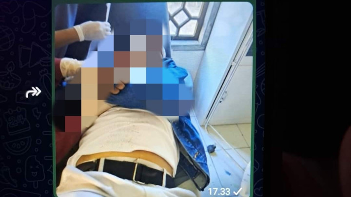 Jatuh di Jalan Poros Bontang- Sangatta, Pemotor Asal Loktuan Dilarikan ke RSUD