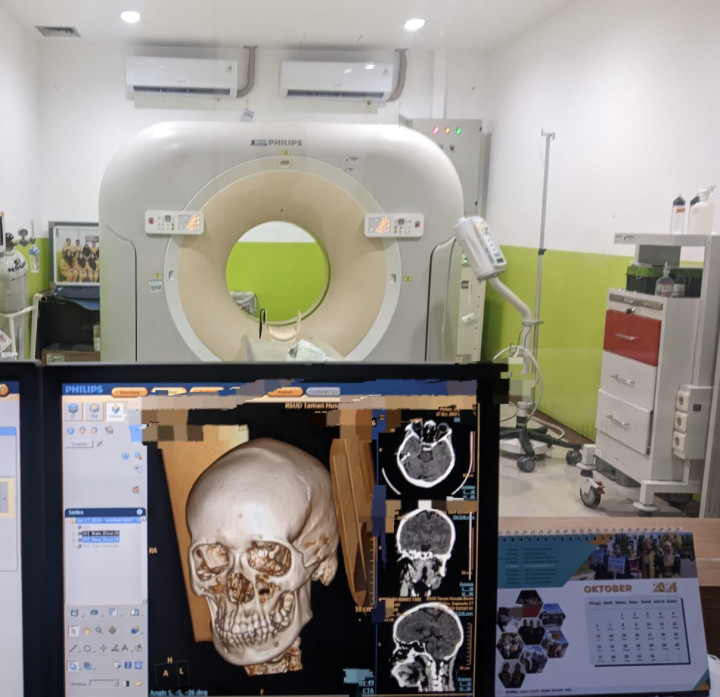 Tips dari Dokter Spesialis Radiologi RSUD Bontang Cegah Alzheimer di Usia Tua