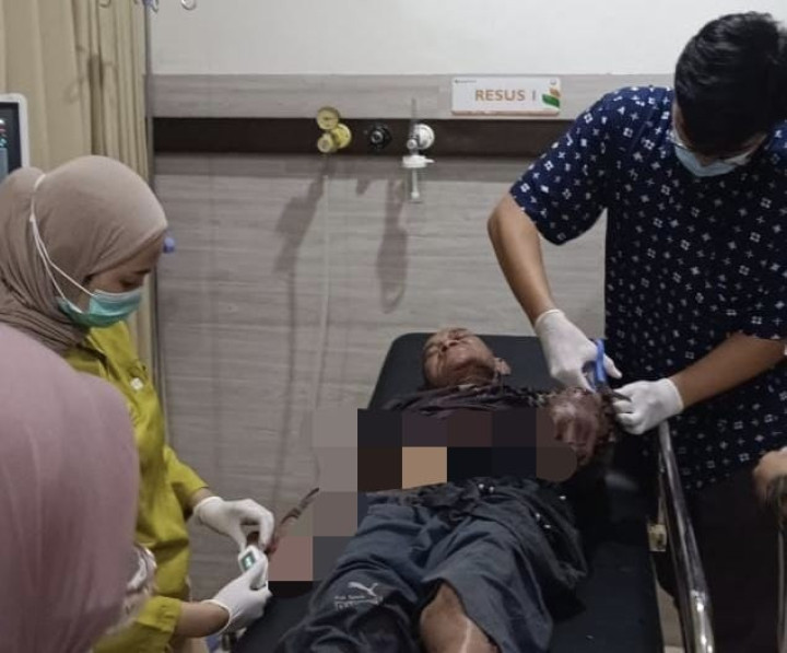 Hendak Ambil Arit yang Jatuh ke Sungai; Pria 74 Tahun Diterkam Buaya di Bontang Utara